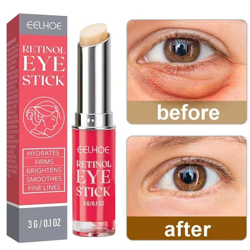 Retinol Oogcrème