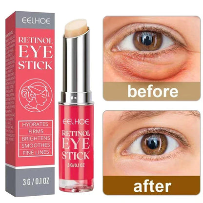 Retinol Oogcrème