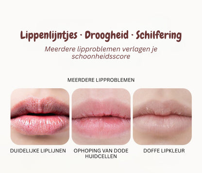 Fruitige lippenbalsemset