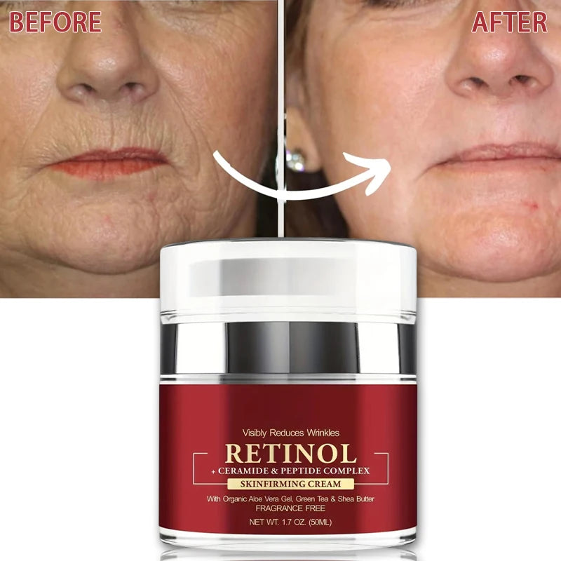 Retinol Anti Rimpelcrème
