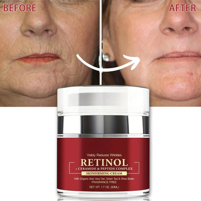Retinol Anti Rimpelcrème