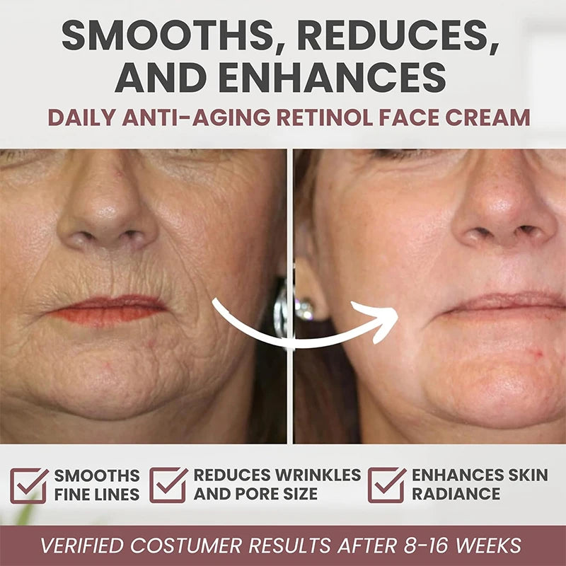 Retinol Anti Rimpelcrème