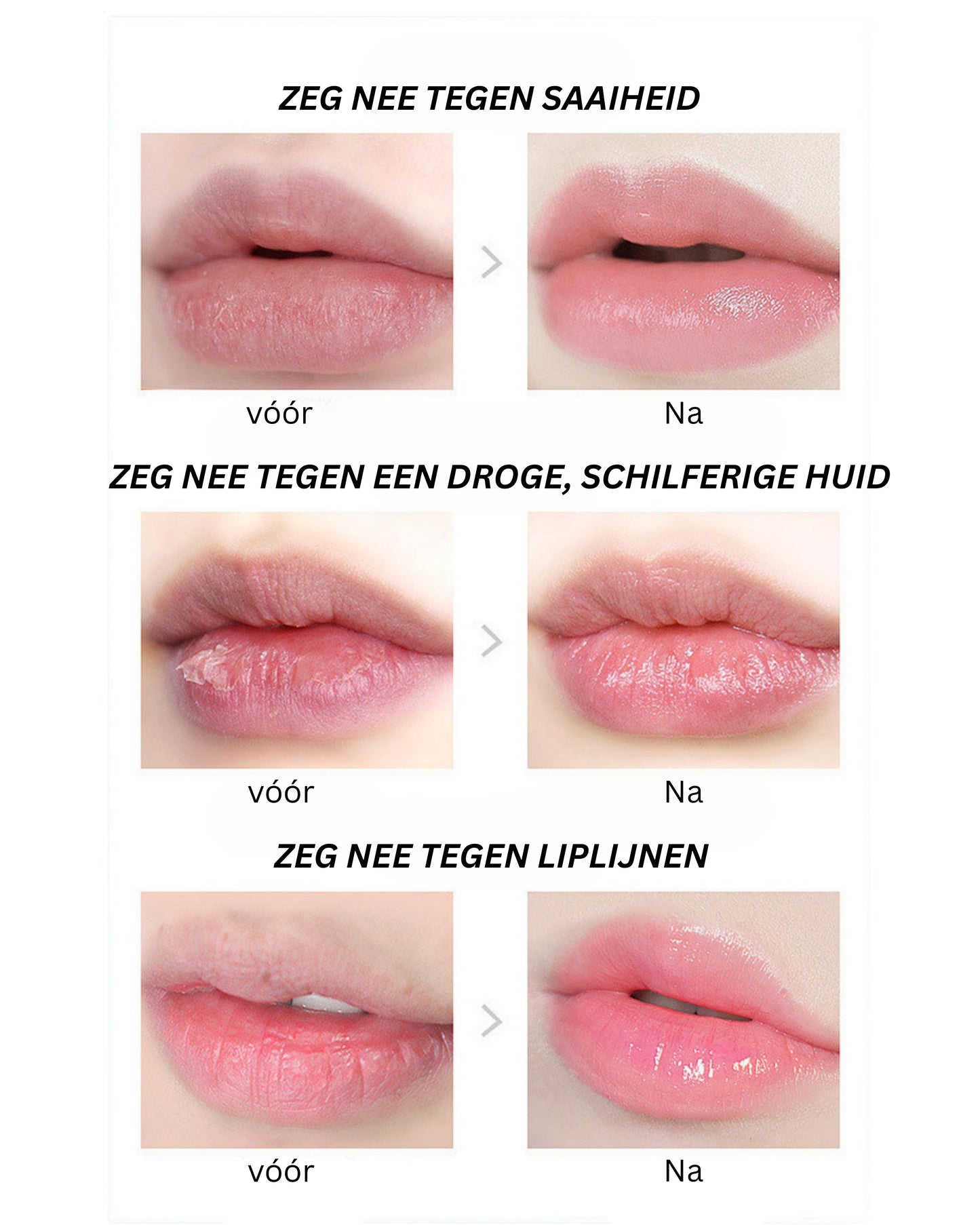 Fruitige lippenbalsemset